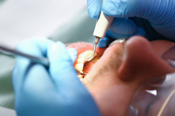 Best After-Hours Emergency Dentist in Hurlburt Field, FL