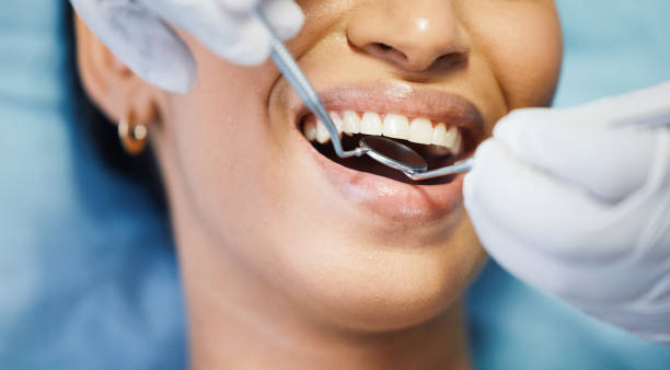 Best Emergency Wisdom Teeth Removal in Hurlburt Field, FL